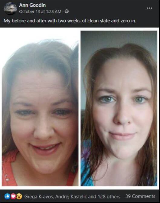 Ann Goodin's before and after photos showing dramatic reduction in facial inflammation after two weeks of Clean Slate and Zero-In